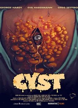 poster film Cyst